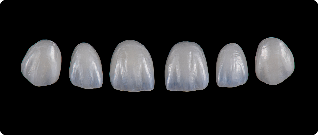 무삭제라미네이트